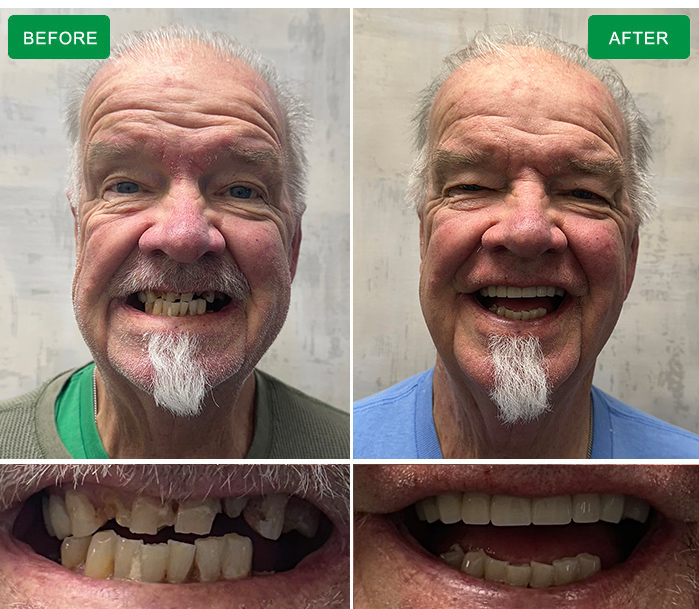 before and after