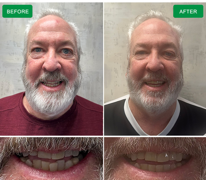 before and after