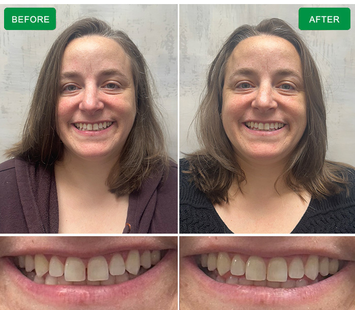 before and after