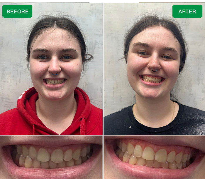 before and after